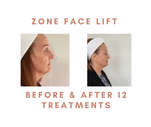 280894696 765781668169837 3067278414210831866 n