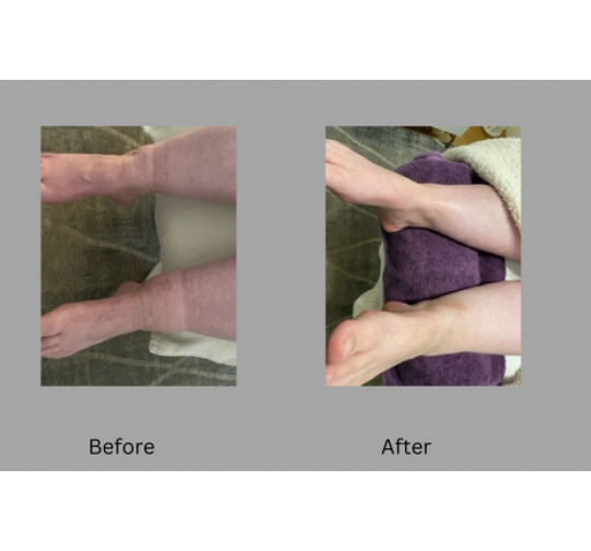 Reflexology Lymph Drainage